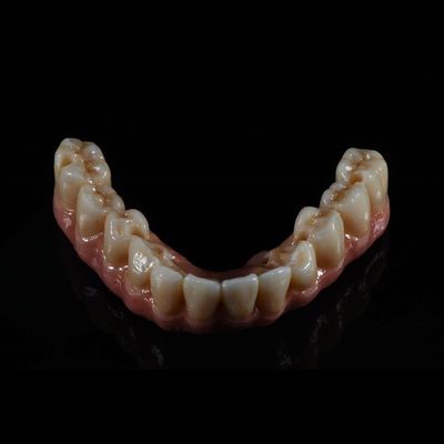qualità  Fixed Restorations Full Arch Zirconia Implant Bridge Denture Teeth fabbrica