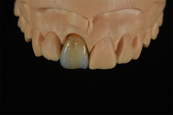 qualità  Affordable Zirconia Crowns with Custom Color Staining - China Dental Lab fabbrica